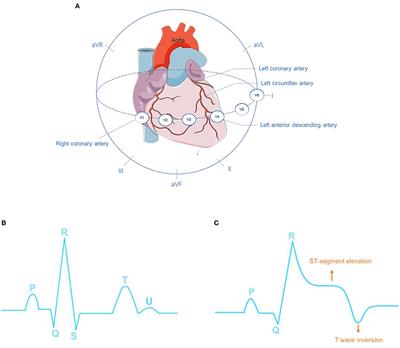 Deep Learning for Detecting and Locating Myocardial Infarction by Electrocardiogram: A Literature Review